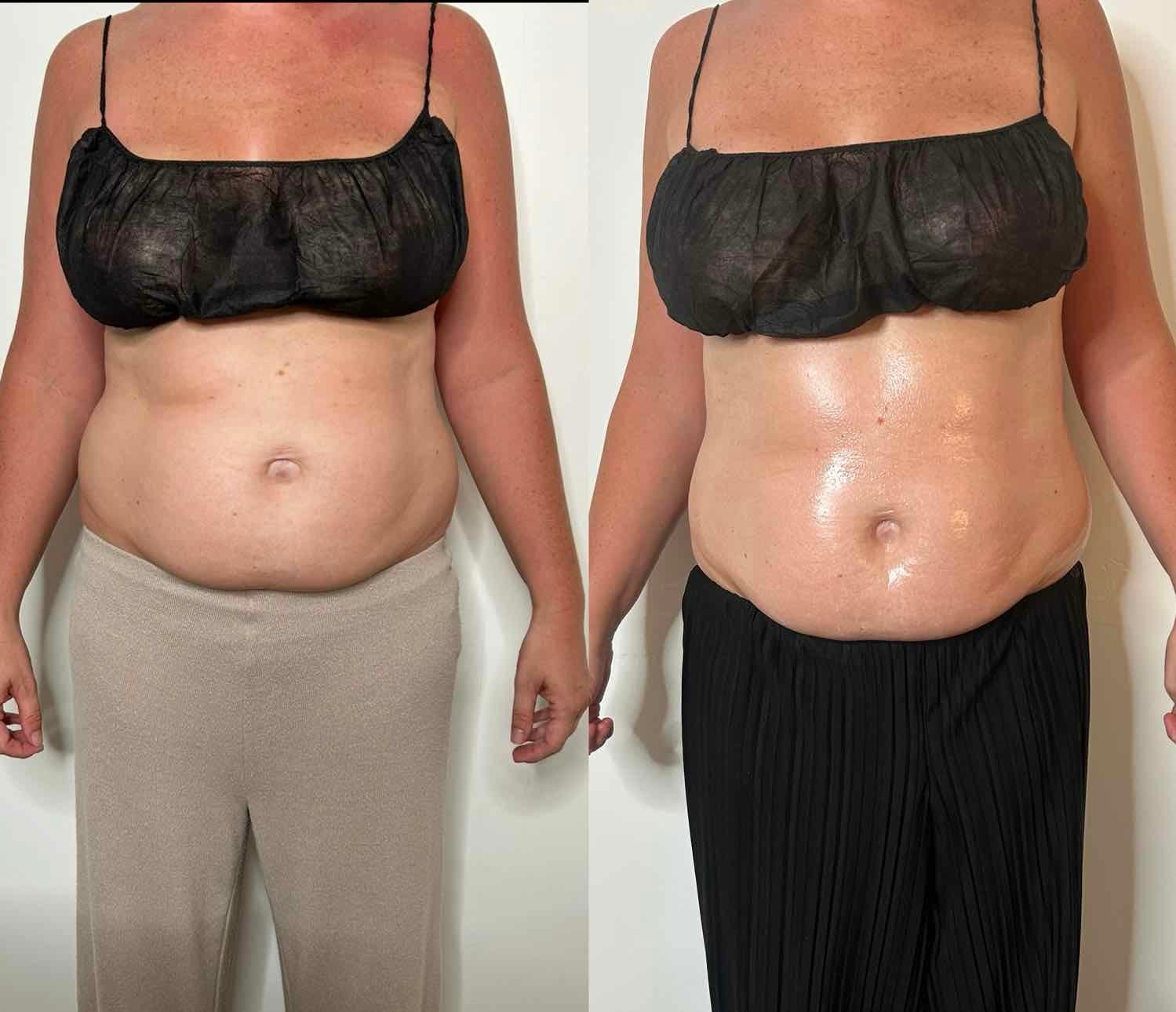 Before & After Results