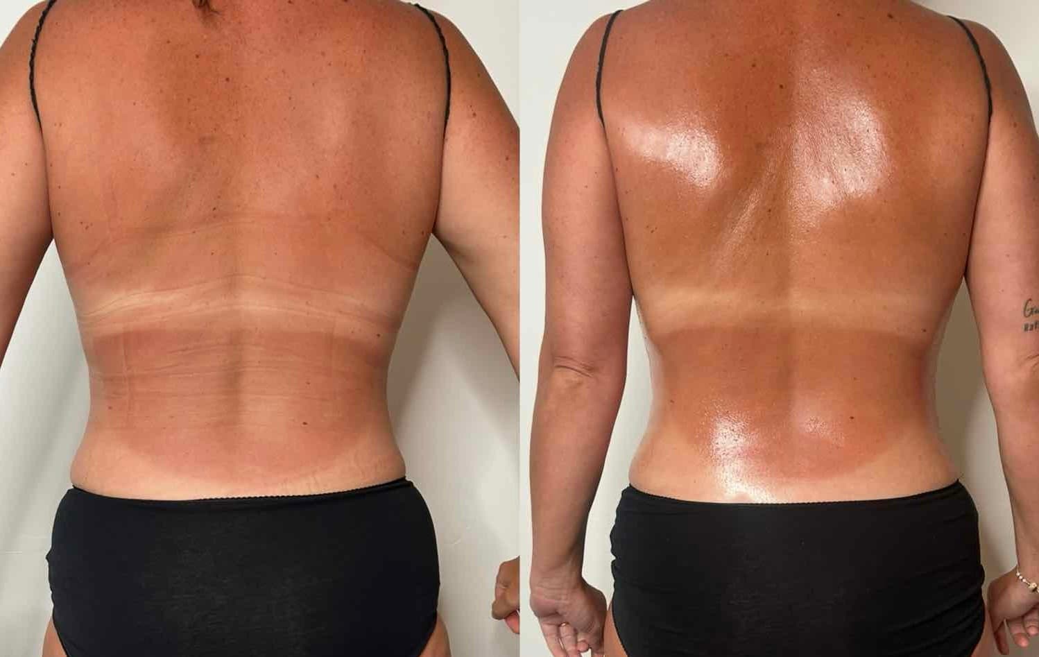 Before and After Transformation 13