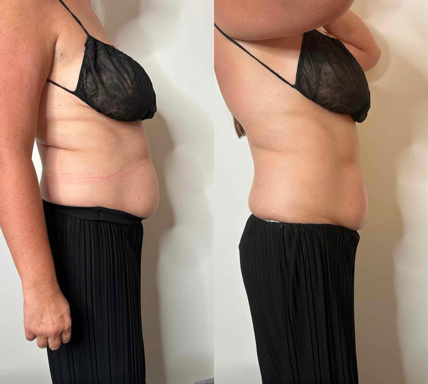 Before and After Transformation 3