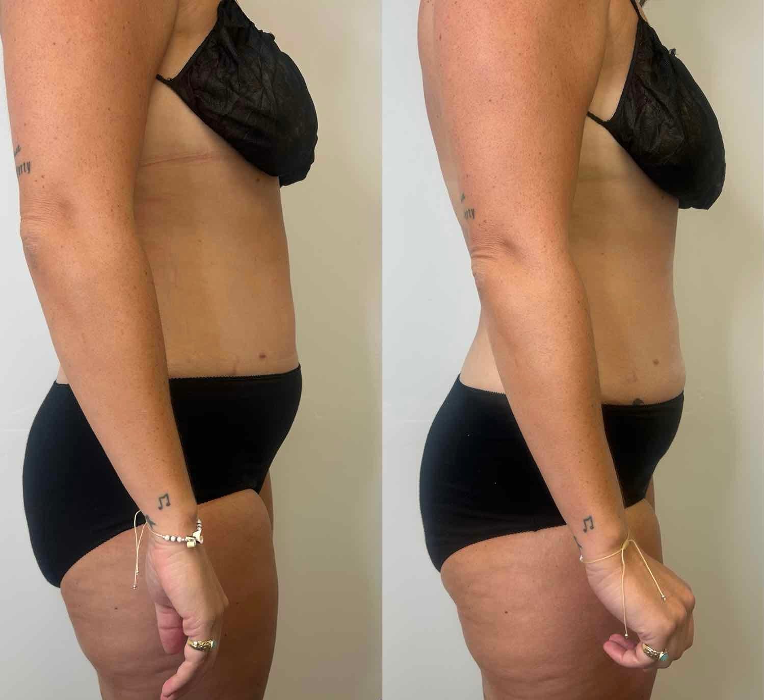 Before and After Transformation 5