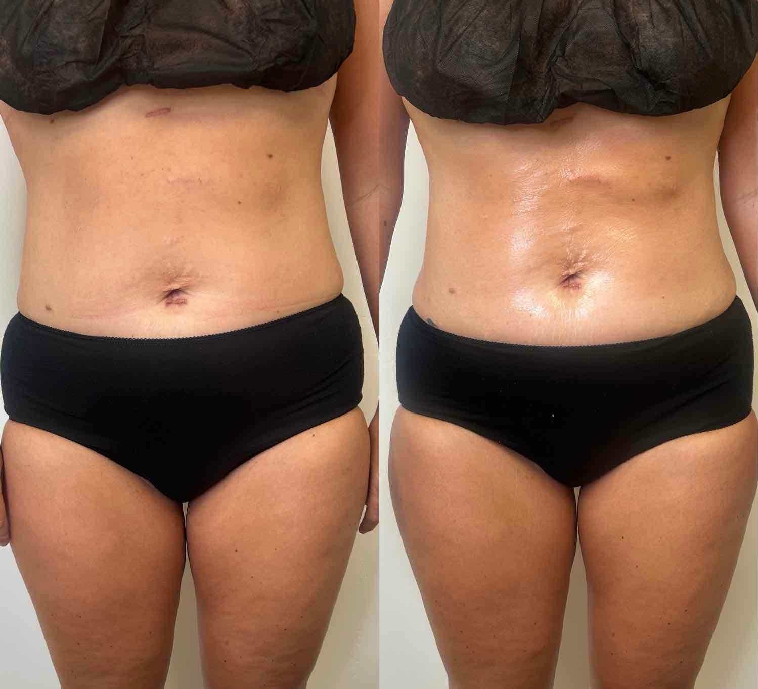 Before and After Transformation 7