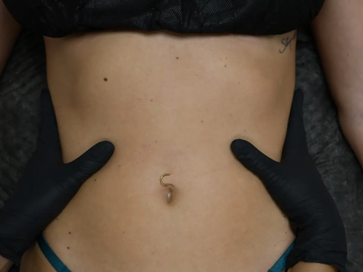 Lymphatic Drainage Therapy